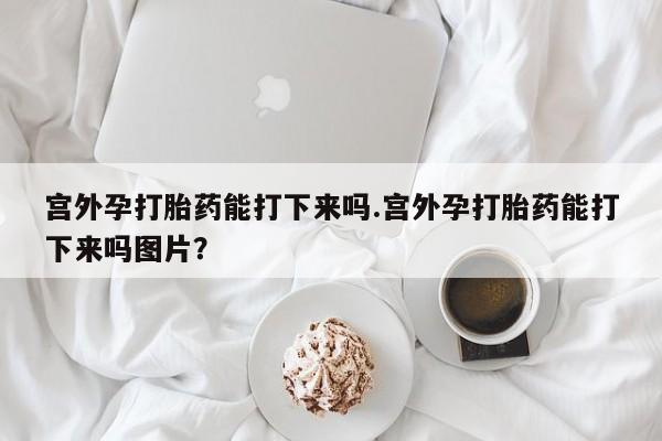 网上哪里可以买米非和米索，宫外孕打胎药能打下来吗.宫外孕打胎药能打下来吗图片？